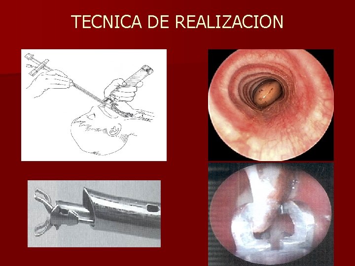 TECNICA DE REALIZACION TECNICA DE REALIZACION