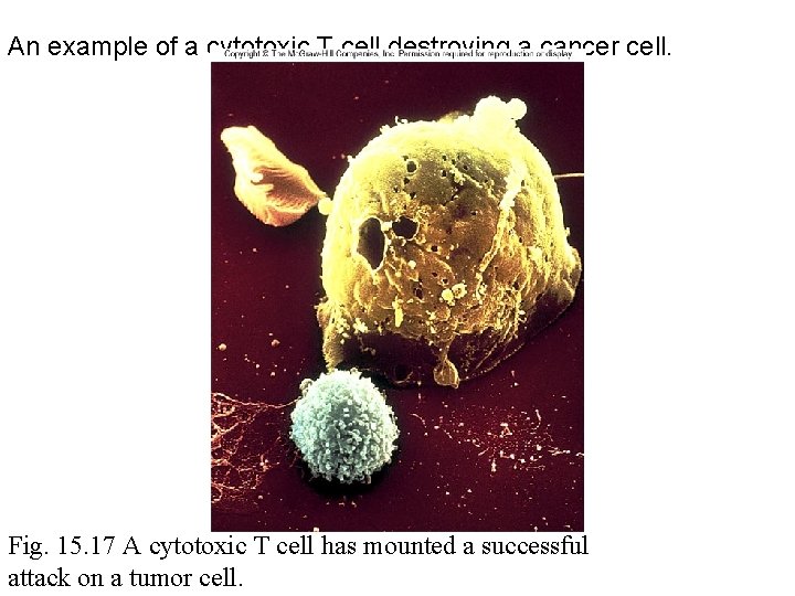 An example of a cytotoxic T cell destroying a cancer cell. Fig. 15. 17