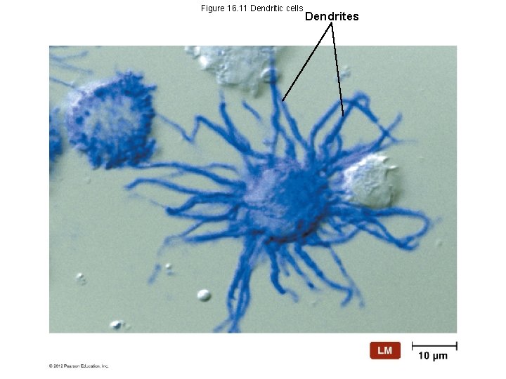 Figure 16. 11 Dendritic cells Dendrites 