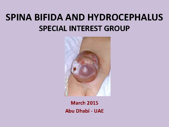 SPINA BIFIDA AND HYDROCEPHALUS SPECIAL INTEREST GROUP March 2015 Abu Dhabi - UAE 