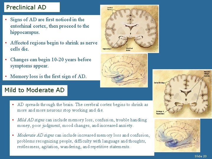 Preclinical AD • Signs of AD are first noticed in the entorhinal cortex, then