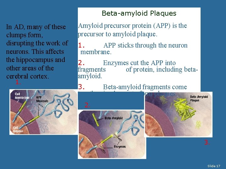 Beta-amyloid Plaques In AD, many of these clumps form, disrupting the work of neurons.