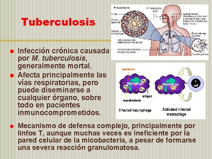 Tuberculosis n n n Infección crónica causada por M. tuberculosis, generalmente mortal. Afecta principalmente