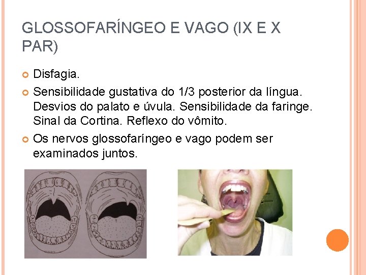 GLOSSOFARÍNGEO E VAGO (IX E X PAR) Disfagia. Sensibilidade gustativa do 1/3 posterior da