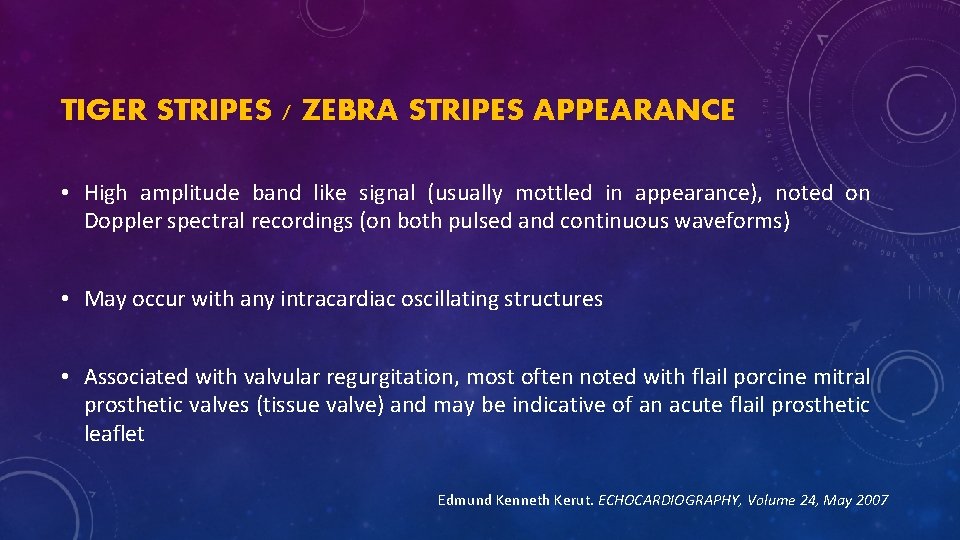 TIGER STRIPES / ZEBRA STRIPES APPEARANCE • High amplitude band like signal (usually mottled