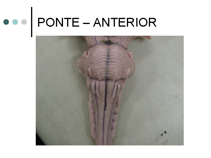 PONTE – ANTERIOR 