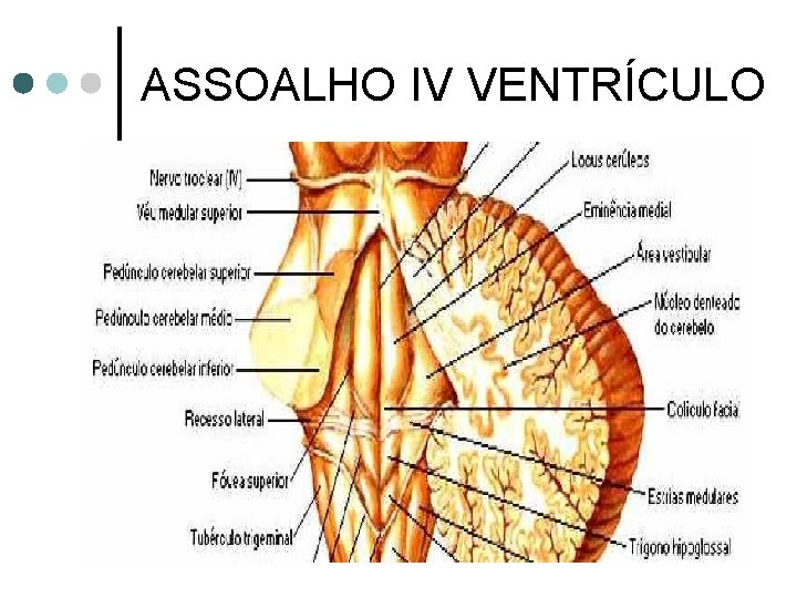 ASSOALHO IV VENTRÍCULO 