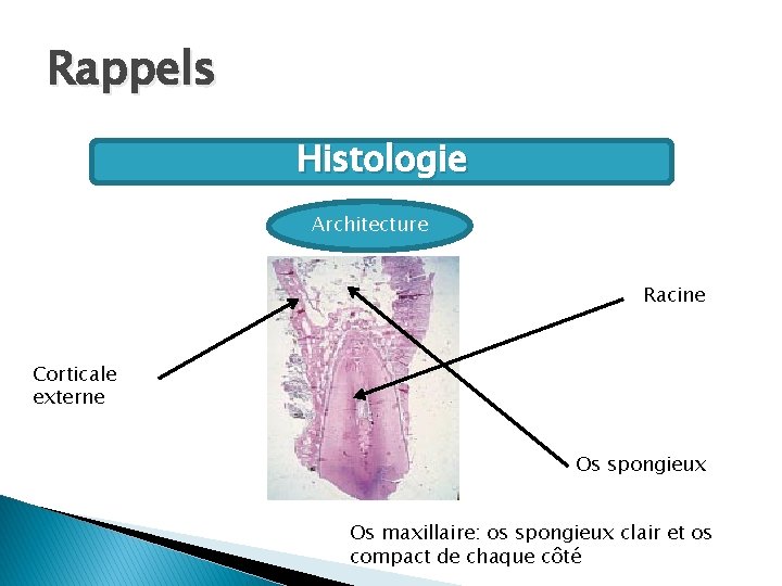 Rappels Histologie Architecture Racine Corticale externe Os spongieux Os maxillaire: os spongieux clair et