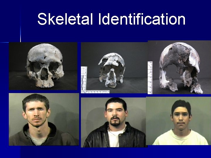 Skeletal Identification 