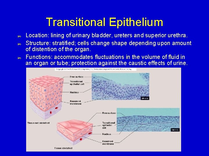 Transitional Epithelium Location: lining of urinary bladder, ureters and superior urethra. Structure: stratified; cells