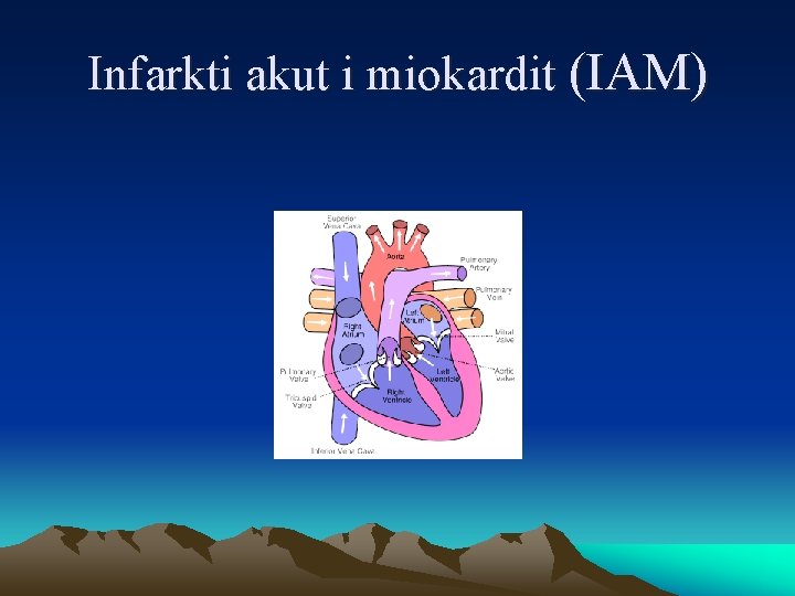 Infarkti akut i miokardit (IAM) 