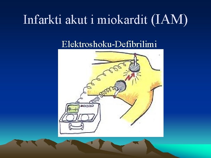 Infarkti akut i miokardit (IAM) Elektroshoku-Defibrilimi 