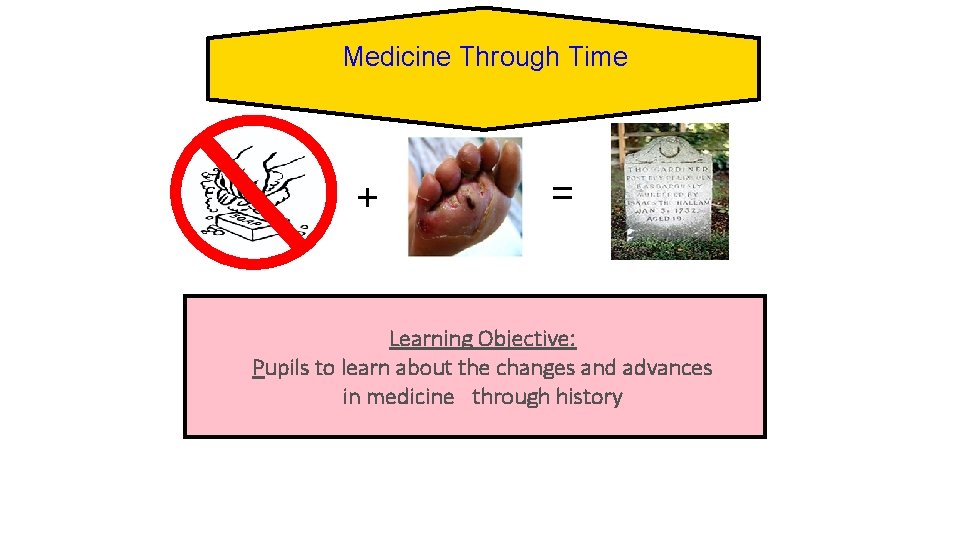 Medicine Through Time + = Learning Objective: Pupils to learn about the changes and
