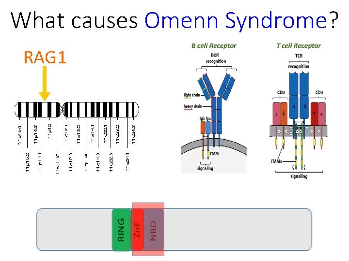 What causes Omenn Syndrome? RAG 1 