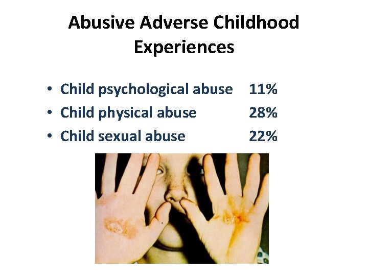 Abusive Adverse Childhood Experiences • Child psychological abuse 11% • Child physical abuse 28%