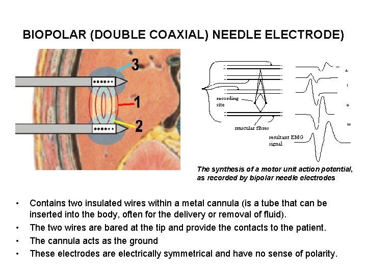 BIOPOLAR (DOUBLE COAXIAL) NEEDLE ELECTRODE) The synthesis of a motor unit action potential, as