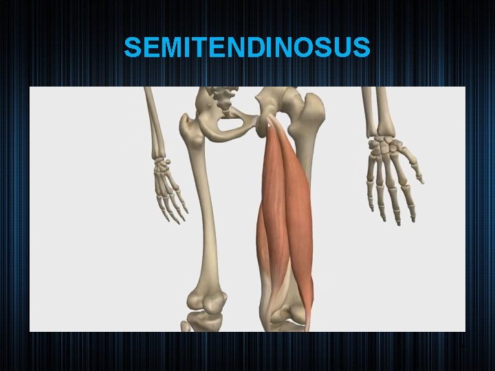 SEMITENDINOSUS 10 