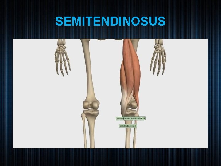 SEMITENDINOSUS 11 