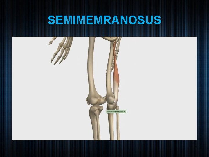 SEMIMEMRANOSUS 13 