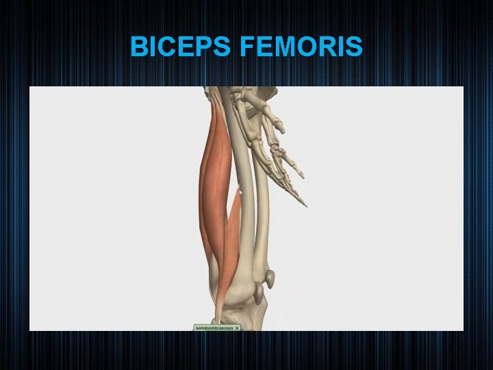 BICEPS FEMORIS 7 