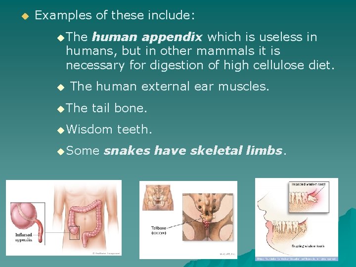 u Examples of these include: u The human appendix which is useless in humans,