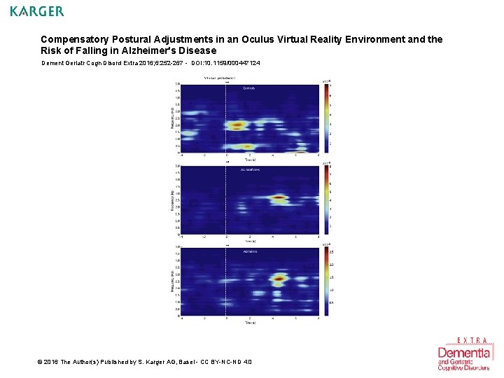 Compensatory Postural Adjustments in an Oculus Virtual Reality Environment and the Risk of Falling