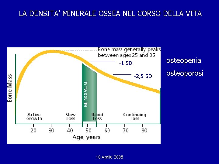 LA DENSITA’ MINERALE OSSEA NEL CORSO DELLA VITA osteopenia -1 SD -2, 5 SD