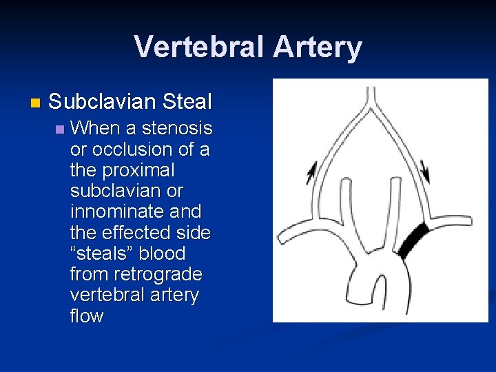 Vertebral Artery n Subclavian Steal n When a stenosis or occlusion of a the