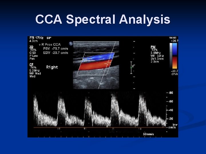 CCA Spectral Analysis 