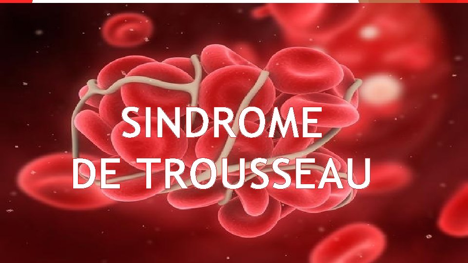 SINDROME DE TROUSSEAU 