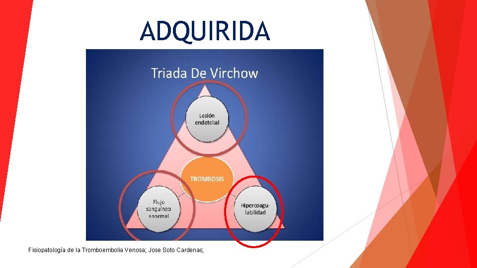 ADQUIRIDA Fisiopatología de la Tromboembolia Venosa; Jose Soto Cardenas; 