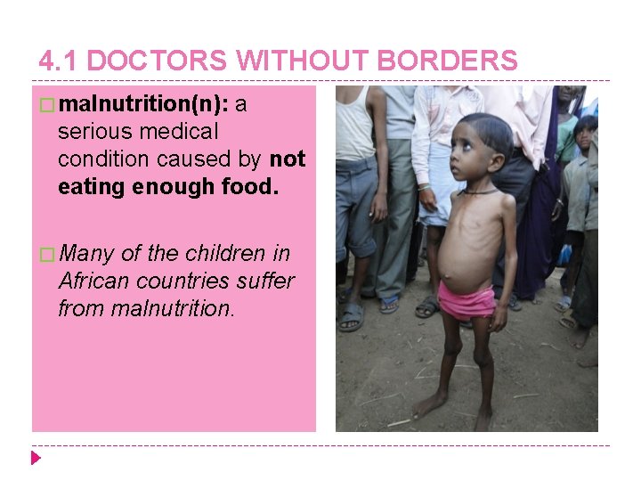 4. 1 DOCTORS WITHOUT BORDERS � malnutrition(n): a serious medical condition caused by not