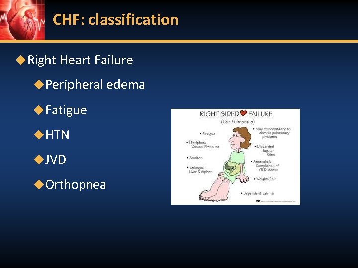CHF: classification ◆Right Heart Failure ◆Peripheral edema ◆Fatigue ◆HTN ◆JVD ◆Orthopnea 