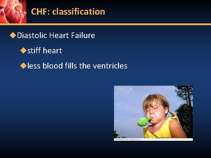 CHF: classification ◆Diastolic Heart Failure ◆stiff heart ◆less blood fills the ventricles 