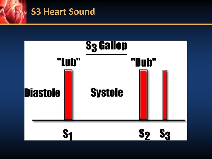 S 3 Heart Sound 