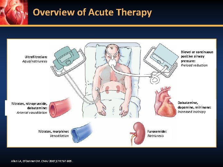 Overview of Acute Therapy 1 6 Ultrafiltration: Aqua/natriuresis 5 2 Dobutamine, dopamine, milrinone: Increased