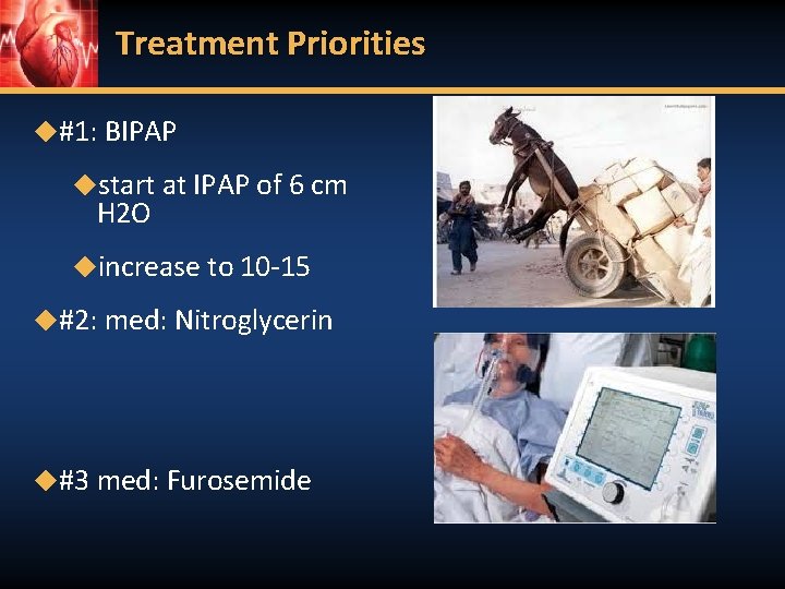Treatment Priorities ◆#1: BIPAP ◆start at IPAP of 6 cm H 2 O ◆increase