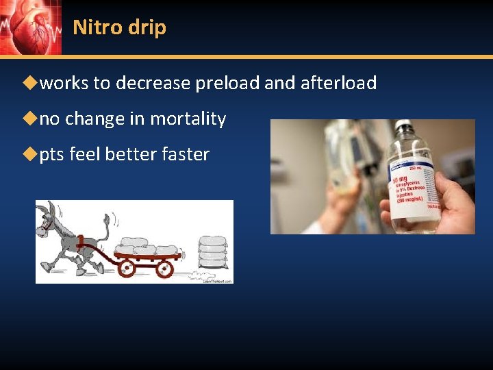 Nitro drip ◆works to decrease preload and afterload ◆no change in mortality ◆pts feel