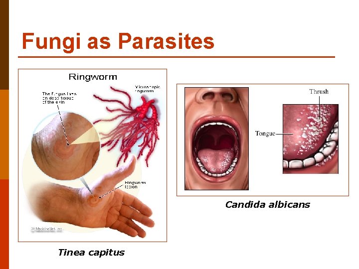 Fungi as Parasites Candida albicans Tinea capitus 