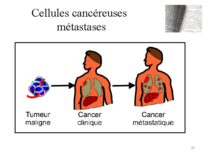 Cellules cancéreuses métastases 20 