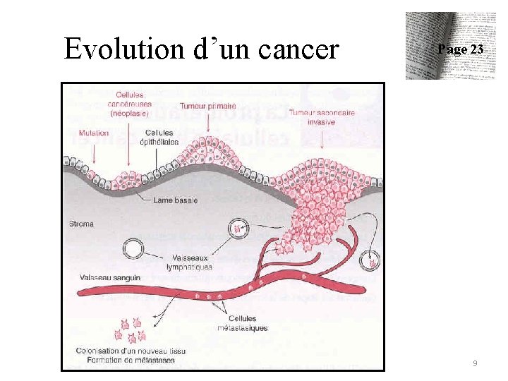 Evolution d’un cancer Page 23 9 