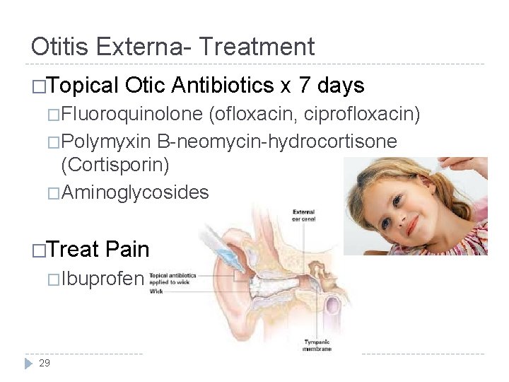 Otitis Externa- Treatment �Topical Otic Antibiotics x 7 days �Fluoroquinolone (ofloxacin, ciprofloxacin) �Polymyxin B-neomycin-hydrocortisone