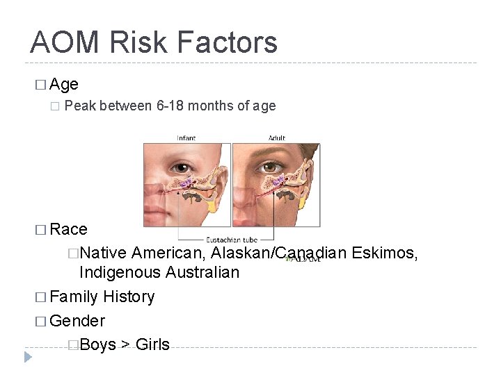 AOM Risk Factors � Age � Peak between 6 -18 months of age �