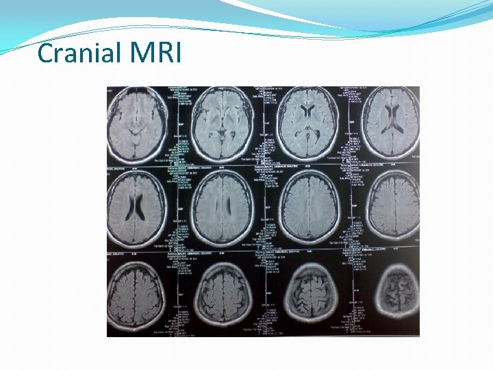 Cranial MRI 