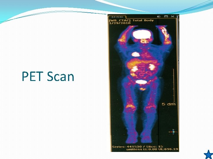 PET Scan 