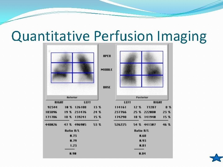 Quantitative Perfusion Imaging 