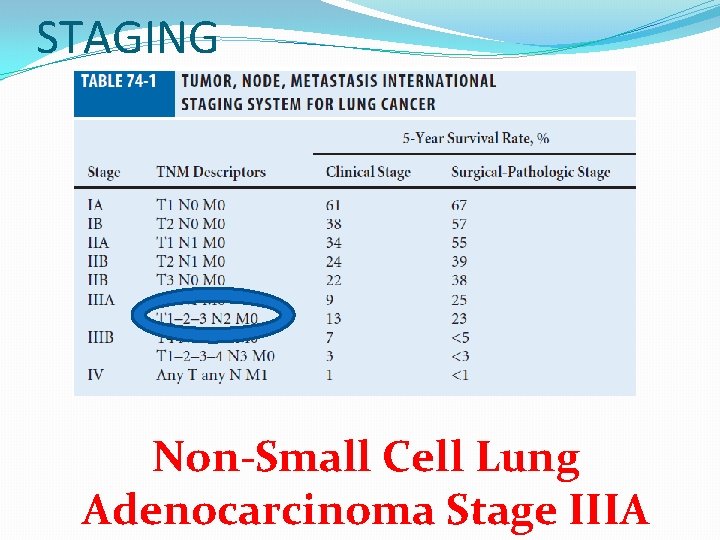STAGING Non-Small Cell Lung Adenocarcinoma Stage IIIA 