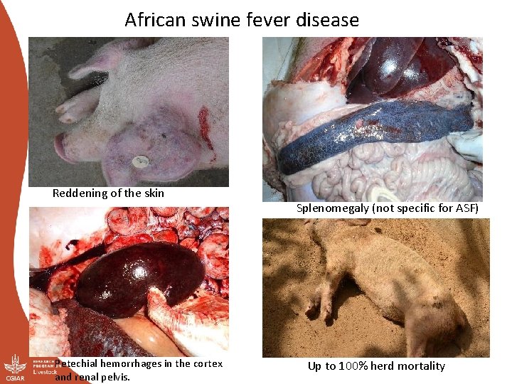 African swine fever disease Reddening of the skin Petechial hemorrhages in the cortex and