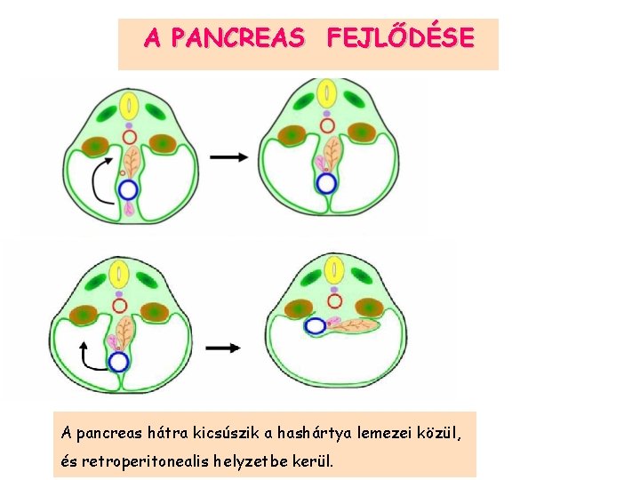 A PANCREAS FEJLŐDÉSE A pancreas hátra kicsúszik a hashártya lemezei közül, és retroperitonealis helyzetbe