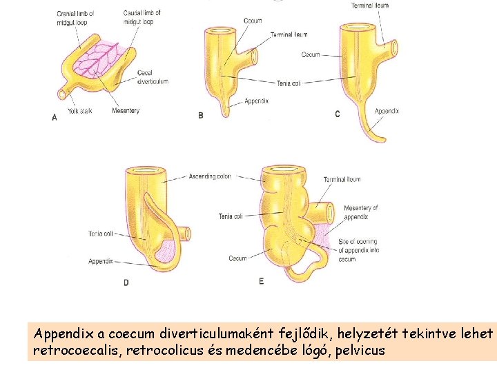 Appendix a coecum diverticulumaként fejlődik, helyzetét tekintve lehet retrocoecalis, retrocolicus és medencébe lógó, pelvicus